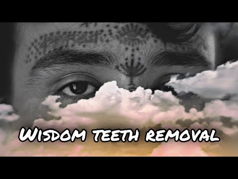 Wisdom Tooth Near Death Experience