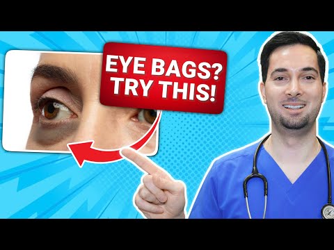 How to get rid of under eye bags for men and women