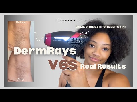 The Best At-Home Laser Hair Removal for Darker Skin | DermRays