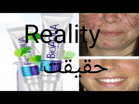 Bio Aqua Acne Product Review | Good or Bad on my self || Bioaqua Acne Cream honest review urdu\hindi