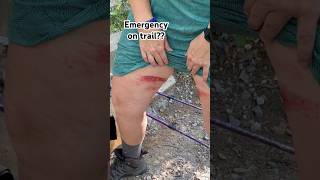 Appalachian Trail VA Emergency on trail? #nature #adventure #appalachiantrail #ems #hiking