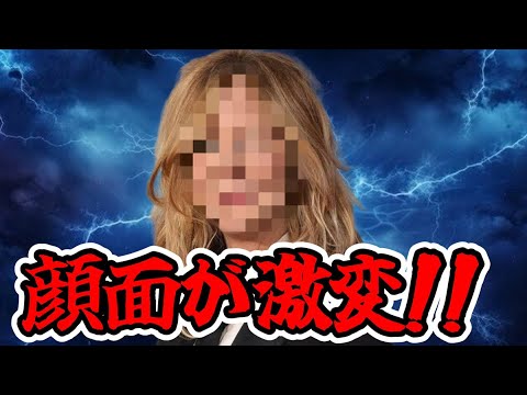 超有名レジェンド女優の顔がえらい事に！整形失敗か？それとも・・・！？