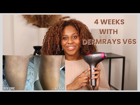 4 Weeks with DermRays V6S: Real Results & Easy Routine!