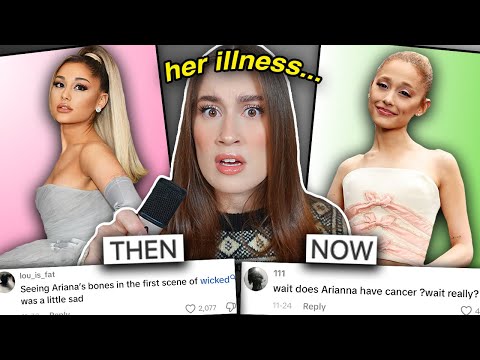 WHAT HAPPENED TO ARIANA GRANDE'S FACE? (irreversible damage)