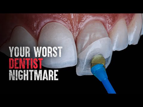 How To Survive the Most Painful Dental Procedures