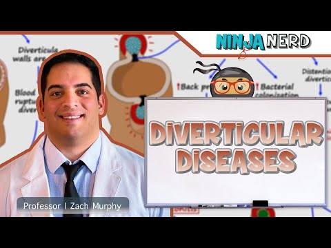 Diverticular Diseases | Clinical Medicine