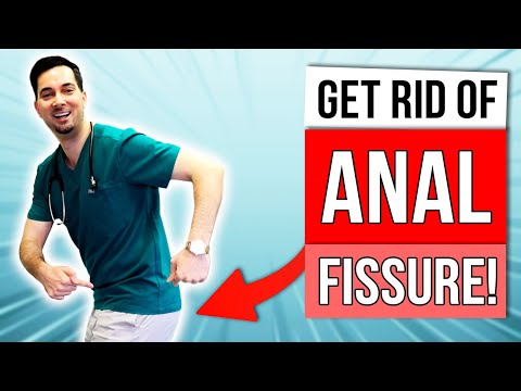 How to get rid of anal fissure treatment at home