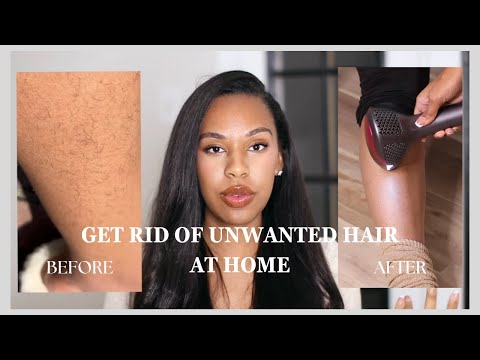 Revealing My Laser Hair Removal Secrets! | DermRays V6S Review