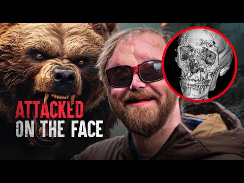 How I Survived Being Mauled by a Bear