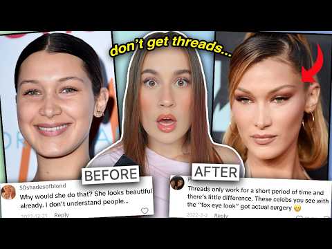 THREAD LIFTS ARE RUINING YOUR FACE (scientifically proven)