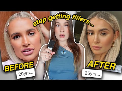 PLEASE DISSOLVE YOUR FILLERS (you look bad)