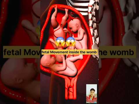 WONDER OF TRIPLETS INSIDE THE WOMB (3D ANIMATION)